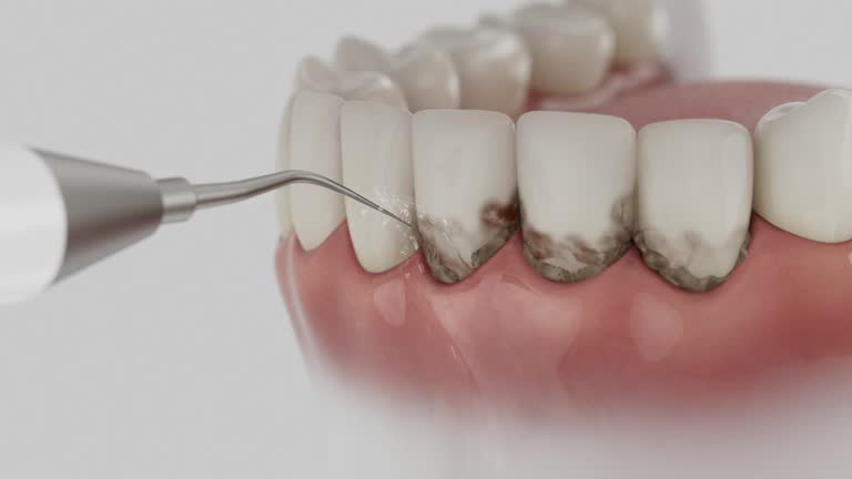Reliable Dental Implants contractor in Granville, IL by Smile Center Dentistry